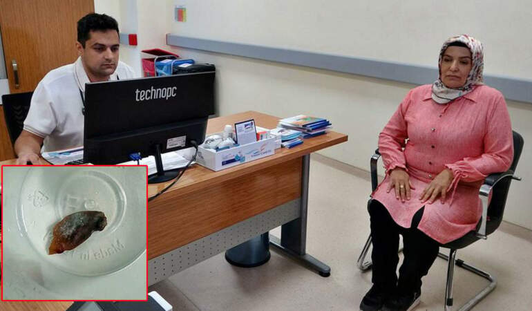 Çekirdek sevdası, 1,5 yıldır geçmeyen gizemli hastalığa yol açtı!