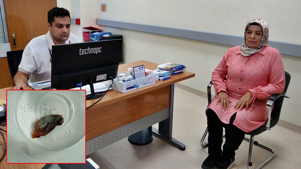 Çekirdek sevdası, 1,5 yıldır geçmeyen gizemli hastalığa yol açtı!