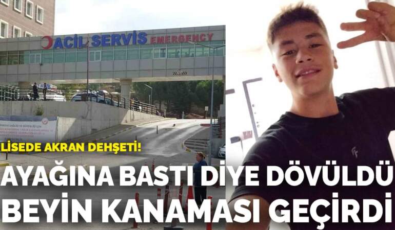 Lisede akran dehşeti! Ayağına bastığı için dövüldü beyin kanaması geçirdi