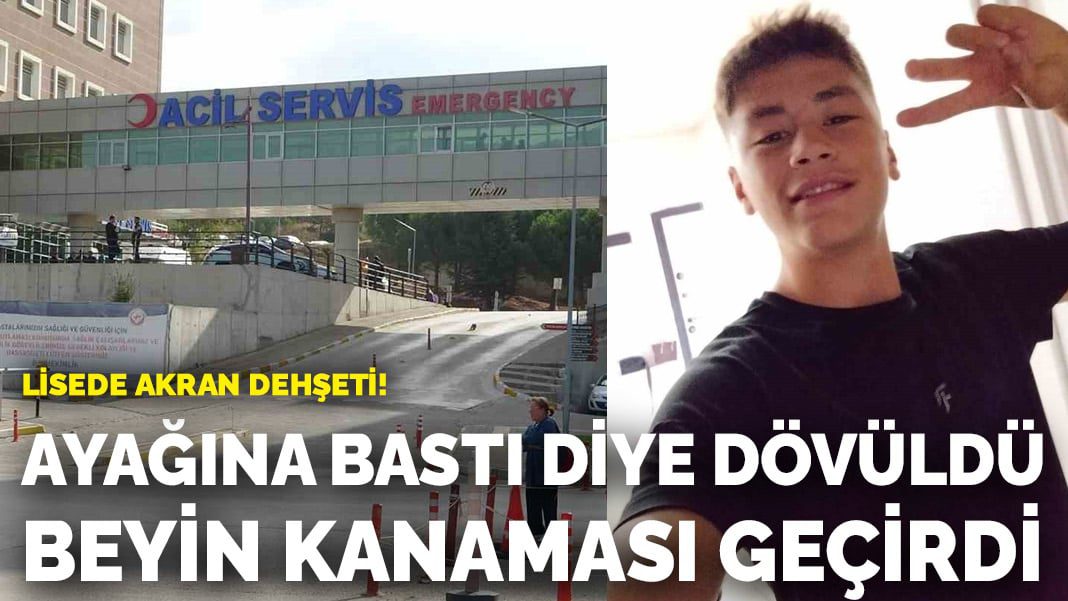 Lisede akran dehşeti! Ayağına bastığı için dövüldü beyin kanaması geçirdi