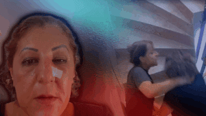 Ankara’da Kedi Besleyen Komşusuna Dehşeti Yaşattı! Annesi Saçını Tuttu, Oğlu Yumrukladı… Burnunda 3 Kırık Var