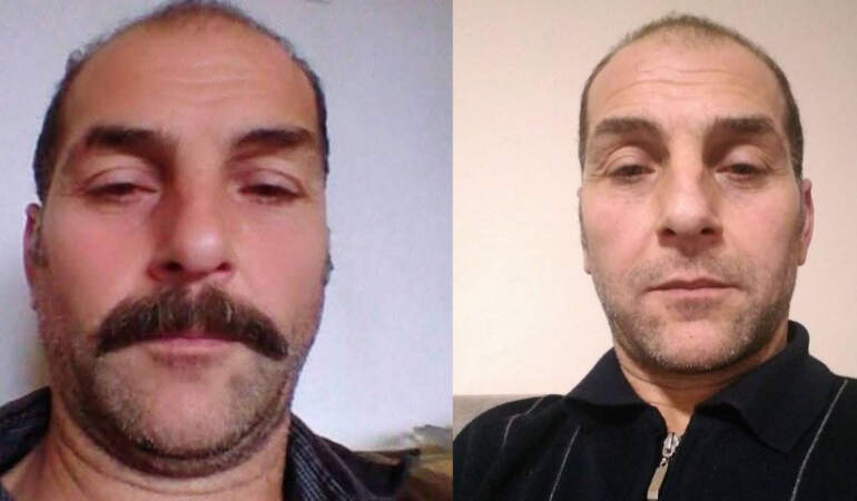 Artvin’de Faciа: Üzerine Yıldırım Düşen Vatandaş Hayatını Kaybetti