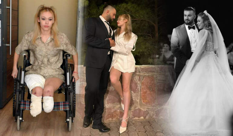 En Mutlu Günleri Faciayla Bitti! Genç Fitness Eğitmeni İki Bacağını Kaybetti