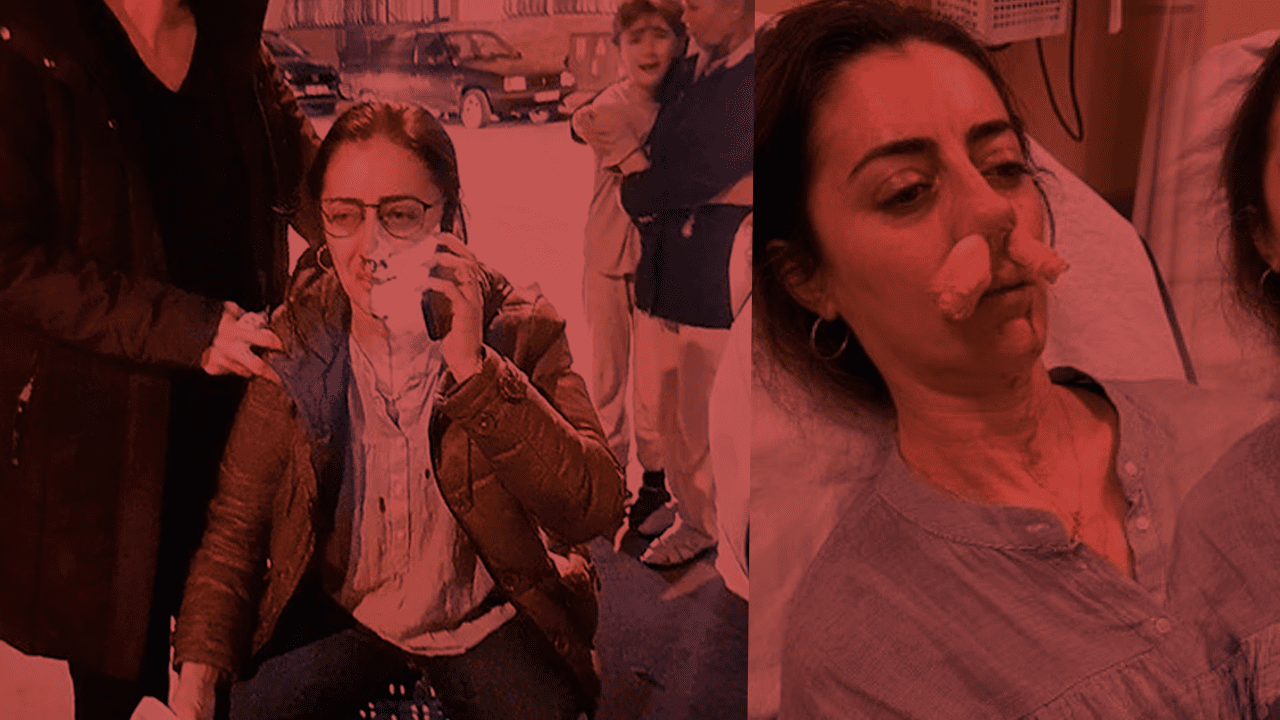 Eşinin Sevgilisi Sandığı Kadını Öldüresiye Dövmüştü! İstenen Ceza Belli Oldu