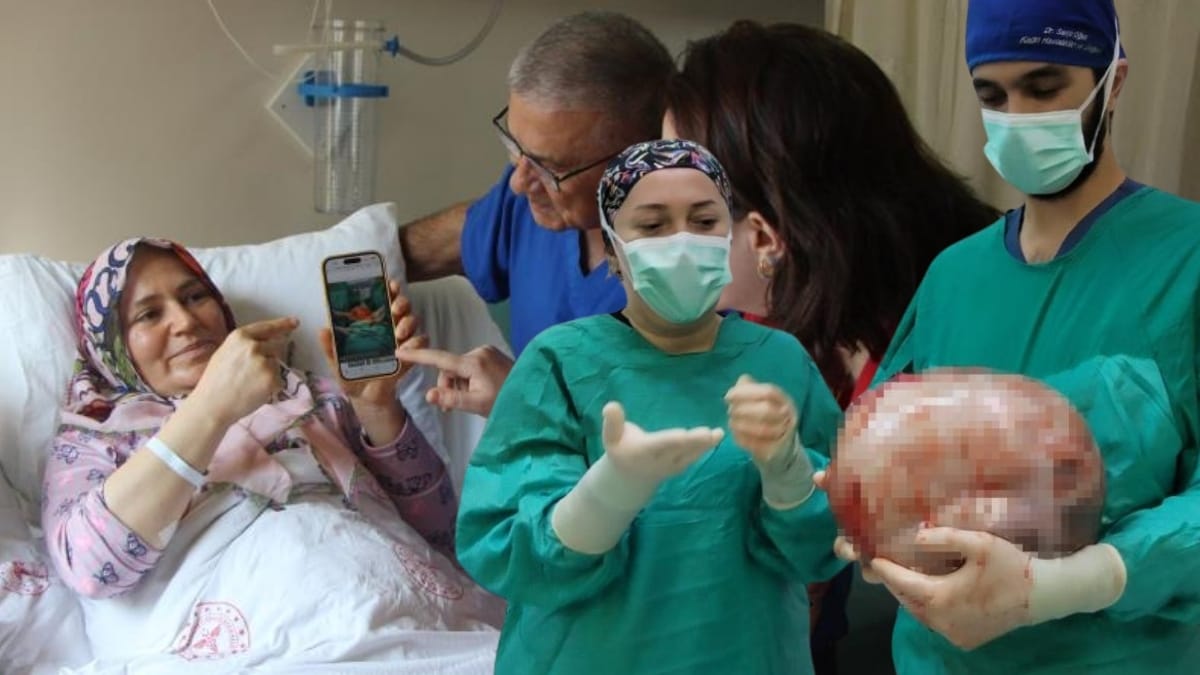 Karnı 9 aylık hamile gibi büyüdü, doktora gidince şok oldu! 8,5 kilo kitle çıkarıldı