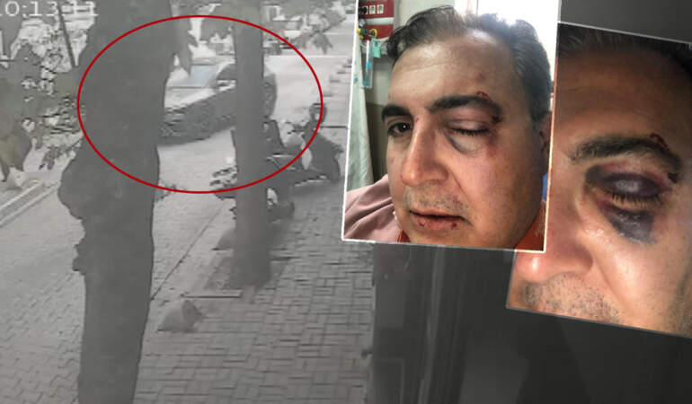 İstanbul’un Göbeğinde Dehşete Düşüren Anlar! Sokak Kedilerini Besleyen İş İnsanına Yumruklu Saldırı