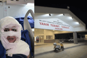 Kadıköy’de Vahşet! Genç Kadını Benzin Dökerek Yaktı