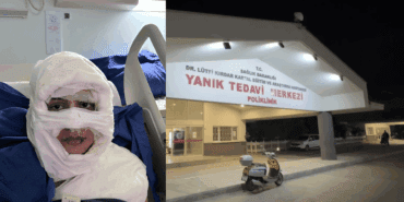 Kadıköy’de Vahşet! Genç Kadını Benzin Dökerek Yaktı