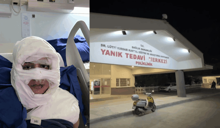 Kadıköy’de Vahşet! Genç Kadını Benzin Dökerek Yaktı