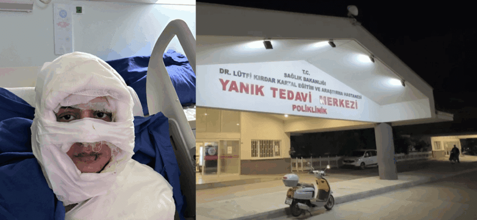 Kadıköy’de Vahşet! Genç Kadını Benzin Dökerek Yaktı