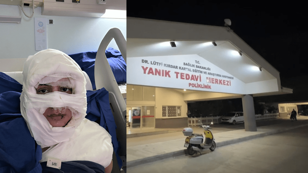 Kadıköy’de Vahşet! Genç Kadını Benzin Dökerek Yaktı