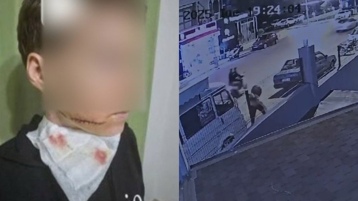 Antalya’da sokak ortasında dehşet! Yolda yürüyen kadını önce yumrukladı sonra yüzüne kesici cisimle saldırdı