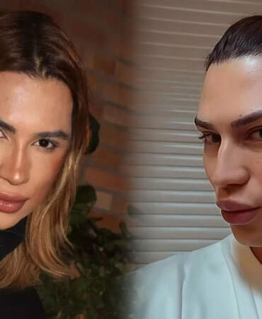 Junior Dutra kimdir ve nasıl öldü? Estetik ameliyat komplikasyonları nelerdir? Fox eyes operasyonu güvenli mi?
