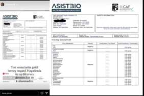 Testi pozitif çıkmıştı, yeniden yaptırdı! Deren Talu uyuşturucu testi sonuçlarını paylaştı