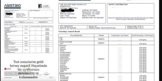 Testi pozitif çıkmıştı, yeniden yaptırdı! Deren Talu uyuşturucu testi sonuçlarını paylaştı