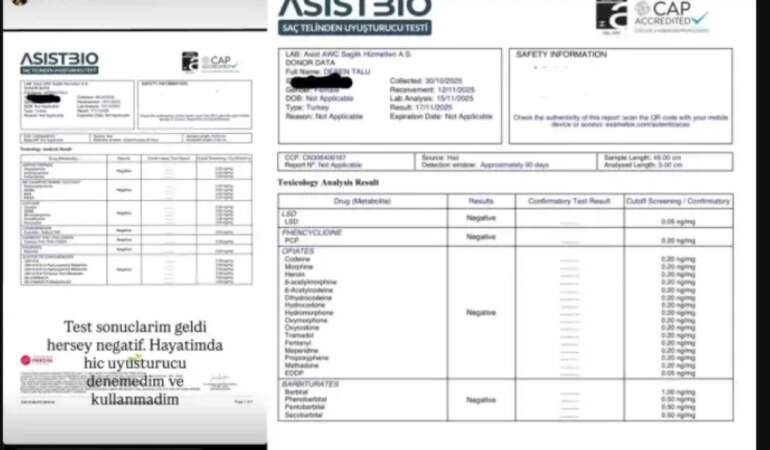 Testi pozitif çıkmıştı, yeniden yaptırdı! Deren Talu uyuşturucu testi sonuçlarını paylaştı