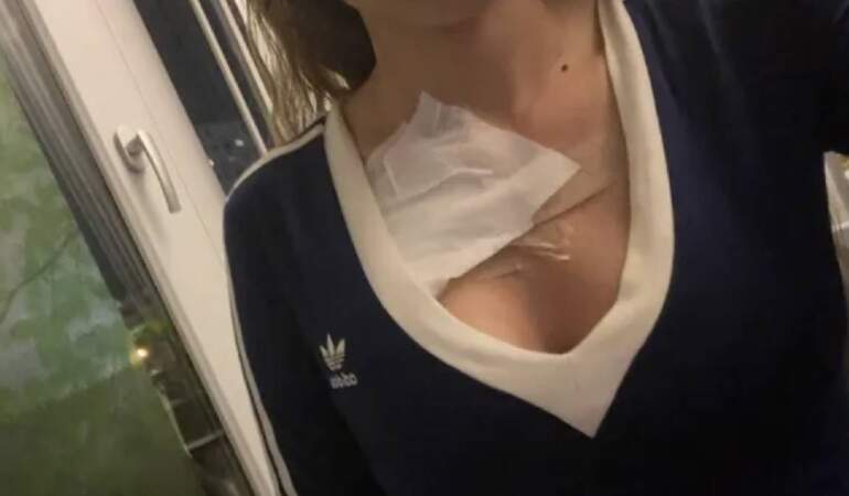 Göğüs estetiği kabusu, doktor hastayı tehdit etti: “Yan tarafta mezarlık var, çok kişi gömdük”