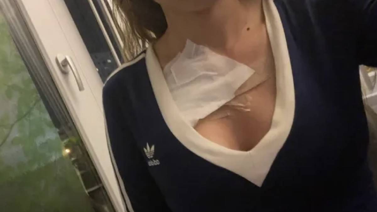 Göğüs estetiği kabusu, doktor hastayı tehdit etti: “Yan tarafta mezarlık var, çok kişi gömdük”