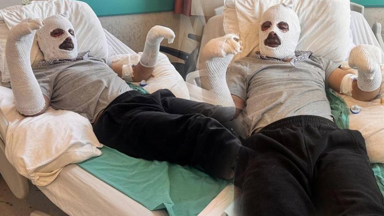 Kars’ta Mutfakta Dehşet: Çay Demlemek İsterken Canından Oluyordu