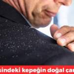 Bu iki malzemeyle kepek sorununu tarihe gömün! Üstelik hem doğal hem ekonomik