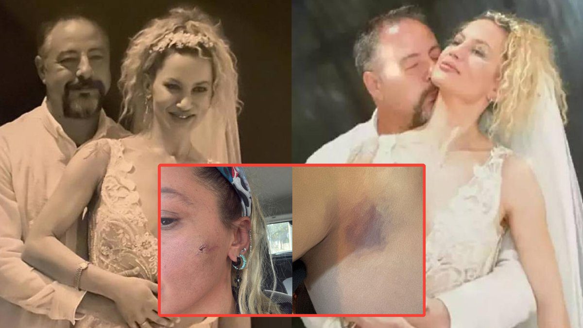 Şiddet gördüğünü söyleyen Yıldız Asyalı’dan şok iddialar! Asyalı canlı yayında yaşadıklarını anlattı