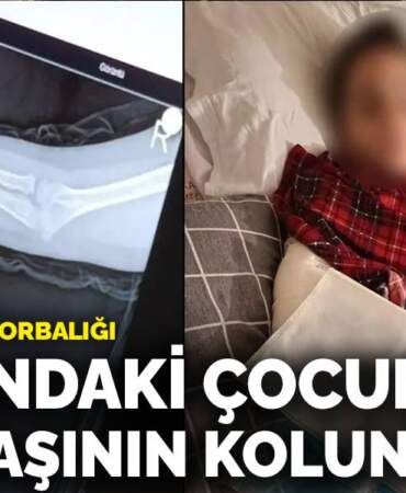 Okulda akran zorbalığı: 9 yaşındaki çocuk arkadaşının kolunu kırdı