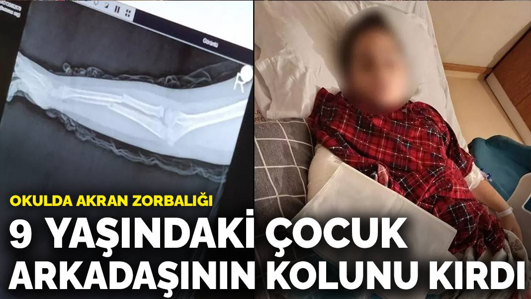 Okulda akran zorbalığı: 9 yaşındaki çocuk arkadaşının kolunu kırdı