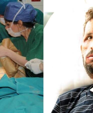 Küçük yaşta ameliyat oldu, yeni bir yüze kavuştu! Türkiye’nin ilk yüz nakli 14 yıl önce ona yapıldı
