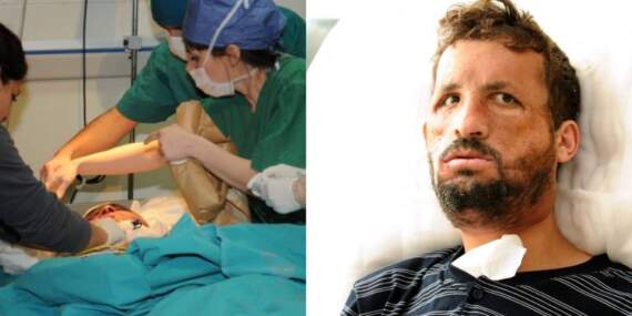 Küçük yaşta ameliyat oldu, yeni bir yüze kavuştu! Türkiye’nin ilk yüz nakli 14 yıl önce ona yapıldı