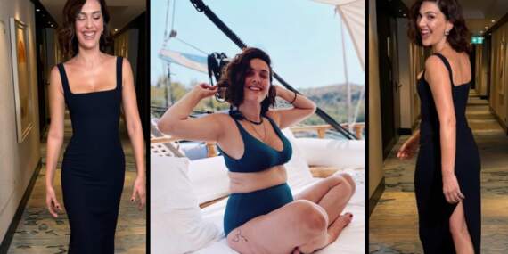 Verdiği kilolarla gündem olmuştu! 4 ayda 20 kilo veren Bergüzar Korel yöntemini ilk kez açıkladı