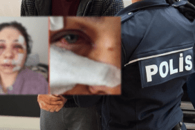 Eşini Ağır Şekilde Darp Eden Polis Tutuklandı! Bakanlardan Peş Peşe Açıklamalar