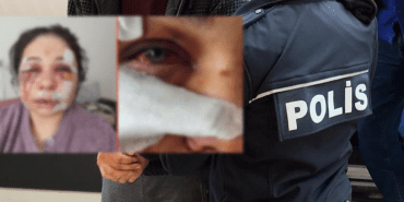 Eşini Ağır Şekilde Darp Eden Polis Tutuklandı! Bakanlardan Peş Peşe Açıklamalar