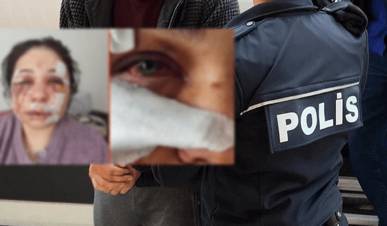 Eşini Ağır Şekilde Darp Eden Polis Tutuklandı! Bakanlardan Peş Peşe Açıklamalar