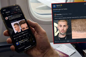Ryanair Justin Bieber saç ekimi paylaşımı nedir? Justin Bieber saç mı ektirdi? Ünlü şarkıcıya Türkiye tavsiyesi!