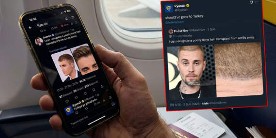 Ryanair Justin Bieber saç ekimi paylaşımı nedir? Justin Bieber saç mı ektirdi? Ünlü şarkıcıya Türkiye tavsiyesi!