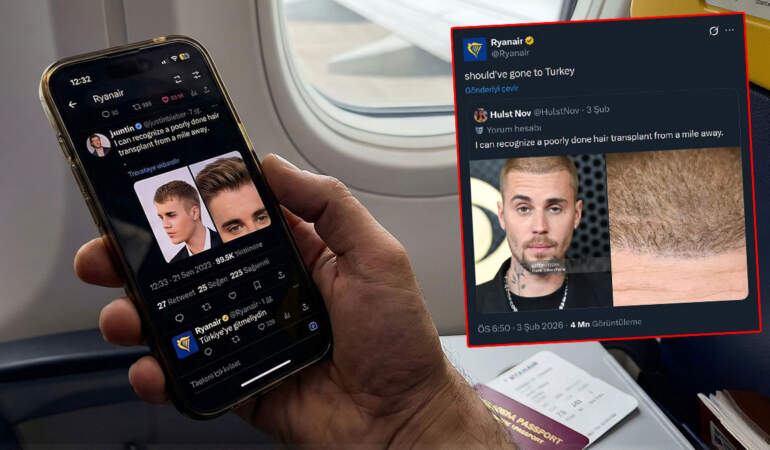 Ryanair Justin Bieber saç ekimi paylaşımı nedir? Justin Bieber saç mı ektirdi? Ünlü şarkıcıya Türkiye tavsiyesi!
