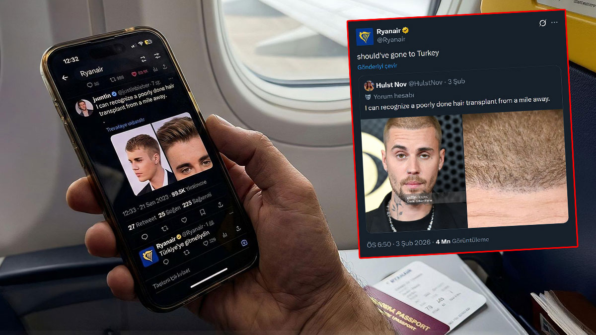 Ryanair Justin Bieber saç ekimi paylaşımı nedir? Justin Bieber saç mı ektirdi? Ünlü şarkıcıya Türkiye tavsiyesi!