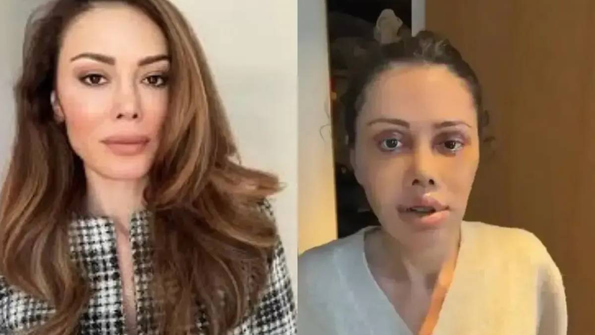 Yüz nakli yaptıran Didem Ceran’dan yeni paylaşım! ‘Harika gözüküyorum’