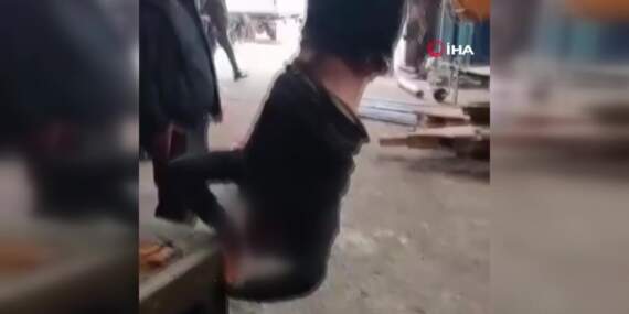 Ankara’da engelli gence işkence! Ayaklarını bağlayıp vince astılar