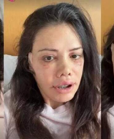 Yüz nakli olan Didem Ceran’dan 14 Şubat paylaşımı! ‘Yanımda duran bir adamın yanında, yalnız hissettim’