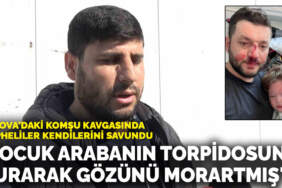 Yalova’daki komşu kavgasında şüpheliler kendilerini savundu: ‘Çocuk arabanın torpidosuna vurarak gözünü morartmış’