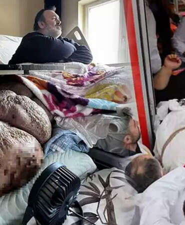 Fil hastalığı tedavisi var mı? Fil hastalığı bacak şişmesi nasıl iner? Sadece tek bacağı 130 kiloya ulaştı