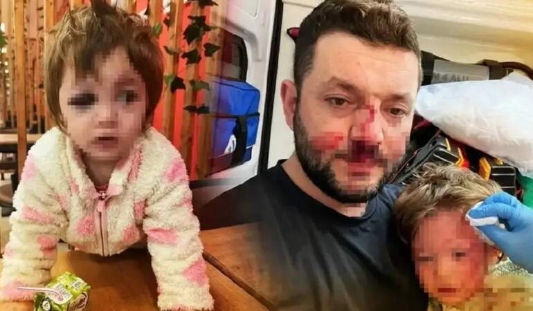 Yalova’da 14 aylık bebek ve babasına saldırı: İçişleri Bakanlığı olayla ilgili müfettiş görevlendirdi