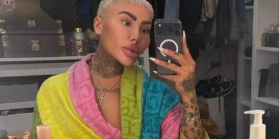 Kim Kardashian’a benzemek istedi hayatını kaybetti! Peş peşe tutuklandılar