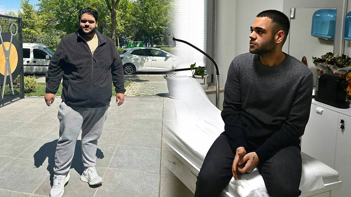 Mide küçültme operasyonu riskli mi? Obezite cerrahisi kimlere uygulanır? 15 ayda 75 kilodan kurtuldu