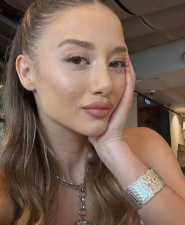 Survivor’da tanındı, estetikle bambaşka biri oldu! Aleyna Kalaycıoğlu’nun doktorunun o paylaşımı herkesi şaşırttı