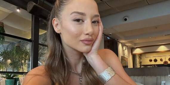 Survivor’da tanındı, estetikle bambaşka biri oldu! Aleyna Kalaycıoğlu’nun doktorunun o paylaşımı herkesi şaşırttı