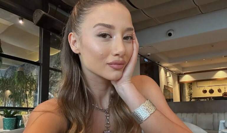 Survivor’da tanındı, estetikle bambaşka biri oldu! Aleyna Kalaycıoğlu’nun doktorunun o paylaşımı herkesi şaşırttı