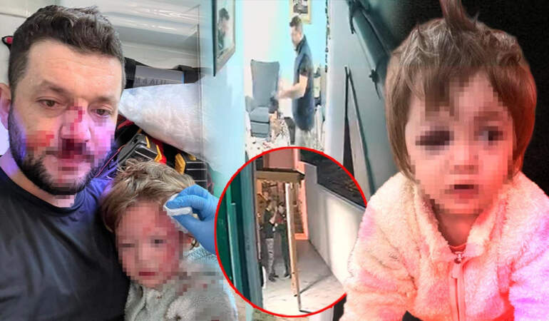 Baba ve 14 Aylık Kızı Öldüresiye Darp Edilmişti… Türkiye’nin Konuştuğu Olayın Dehşet Görüntüleri Ortaya Çıktı