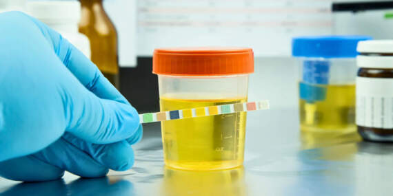 İstanbul’daki Uyuşturucu Soruşturmasında 4 Kişinin Test Sonucu Belli Oldu